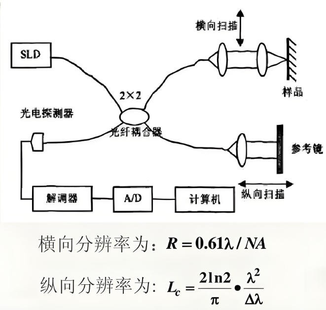 光學(xué)相干斷層掃描 光學(xué)相干斷層掃描